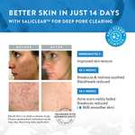 Eclat Skincare Crema avanzada para acné sin alcohol