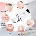 Scrubber Exfoliación Facial Ultrasónica Limpiador de Poros para Limpieza Facial y Cuidado Facial